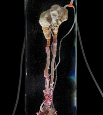 »Petronephros«: Niere der Plastivoren | <i>kidney for the plastivore</i>